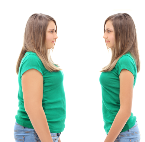 Bariatrik Cerrahi Sonrası Kilo Alımını Önlemede Sitikolinin Potansiyel Rolü 14 4.Bariatrik Cerrahi Sonrasi Kilo Alimini Onlemede Sitikolinin Potansiyel Rolu