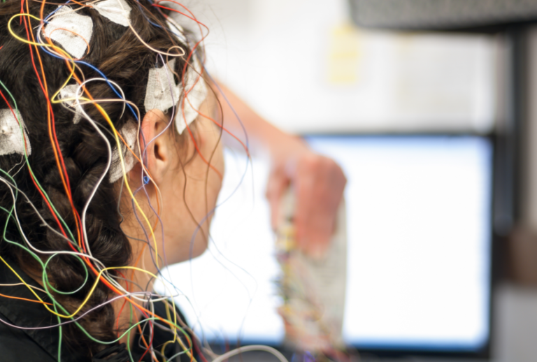 5.Farkli Dozlarda Sitikolin Uygulamasinin Beyin Aktivasyonu Uzerindeki Doz Yanit Iliskisi Kantitatif EEG Analizi