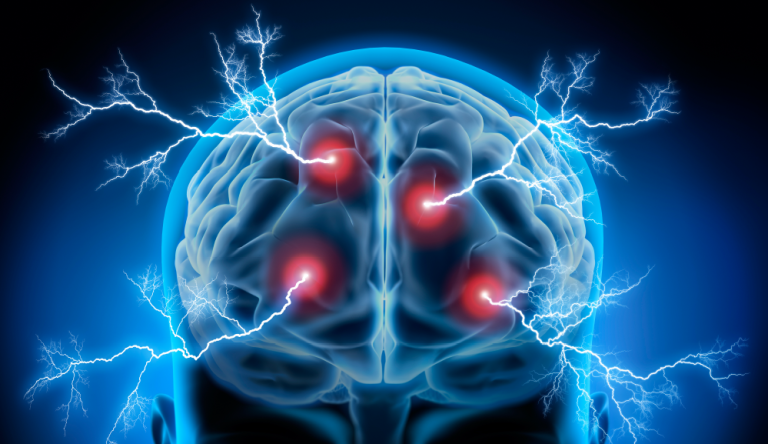 6.Sitikolinin Egzersiz Sonrasi Beyin Aktivasyonu ve Bilissel Iyilesme Uzerindeki Etkilesimi